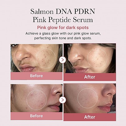 thumb-2_405x405 MEDICUBE PDRN PINK PEPTIDE SERUM