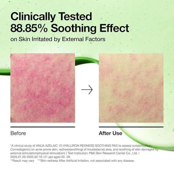 71QLeGuYCPL._SX679 ANUA AZELAIC 10+ HYALURON SOOTHING PAD 90PADS/230ML